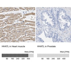 GALM Antibody, Novus Biologicals:Antibodies:Primary Antibodies